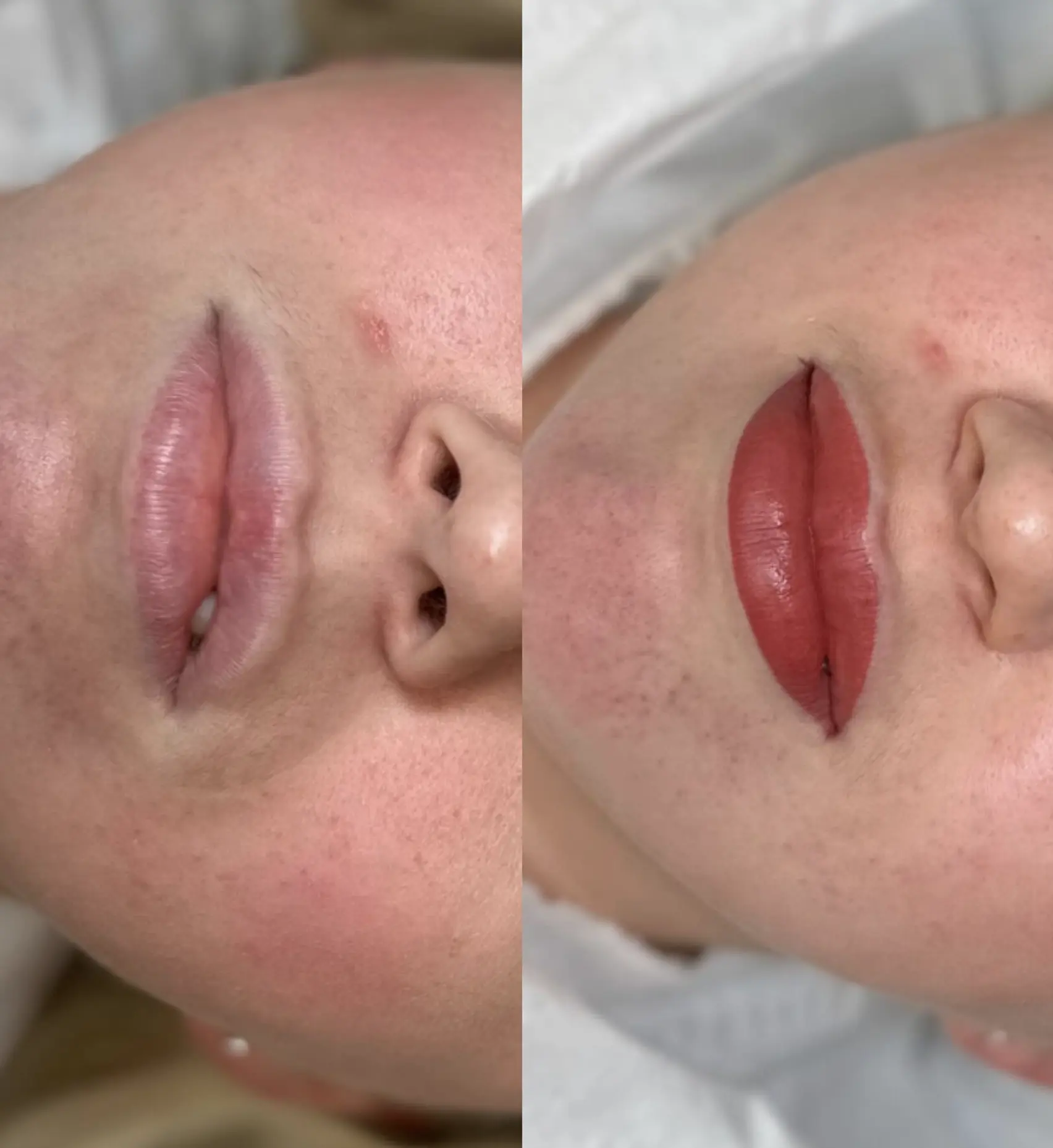 how to fix cracked lips quickly